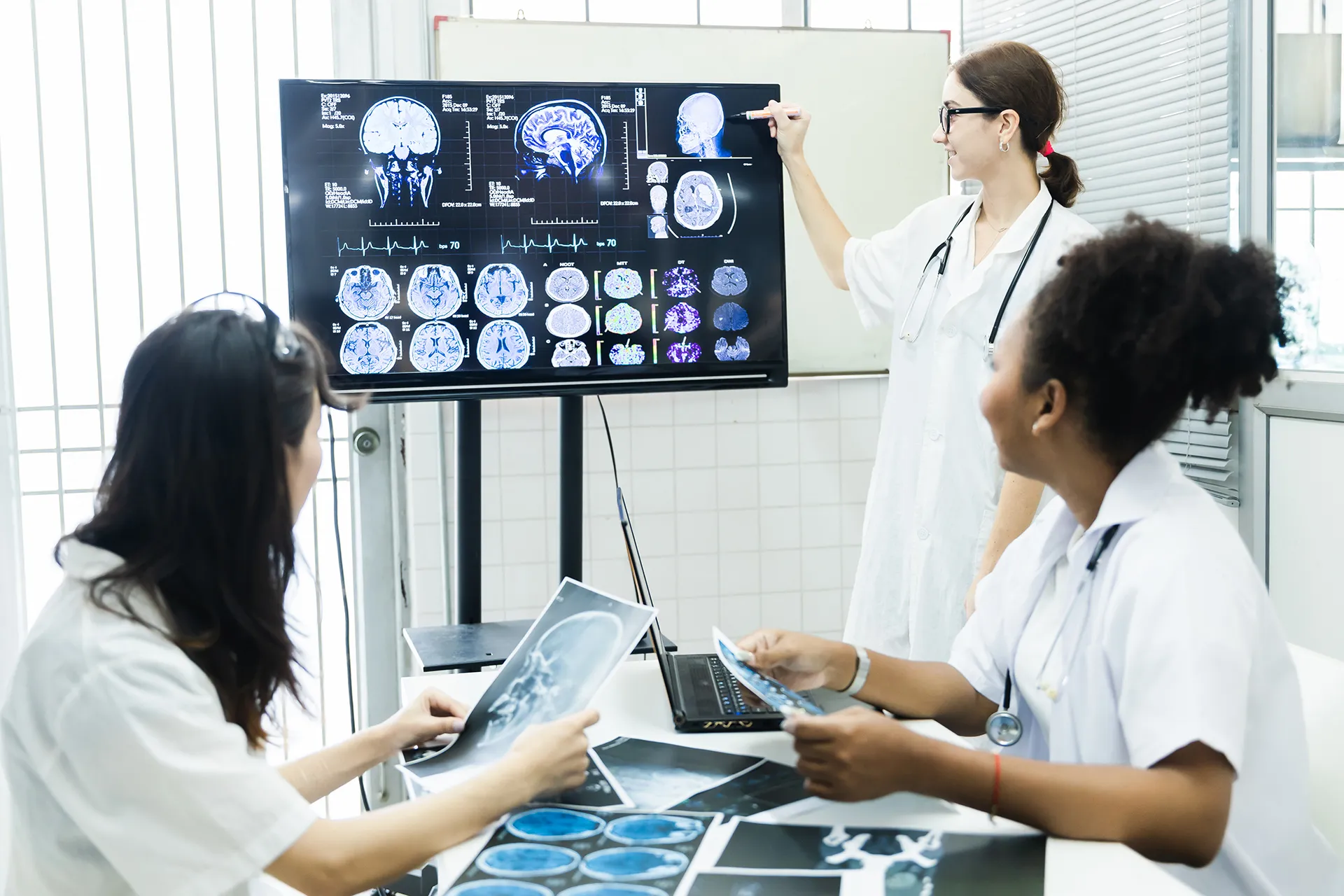 Najnowsze odkrycia w neurologii